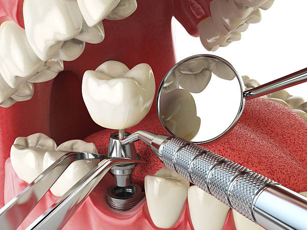 Best Emergency Denture Repair in Womelsdorf, PA